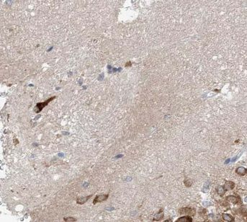 CACNG2 Antibody
