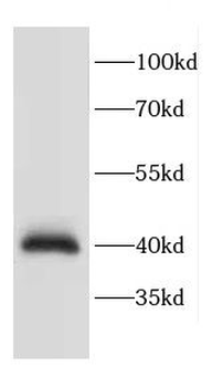 CACNG3 Antibody