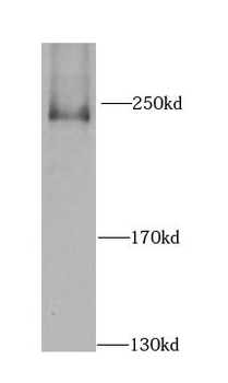 CAD Rabbit Polyclonal Antibody