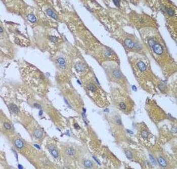 CAD Rabbit Polyclonal Antibody