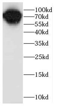 CALD1 Rabbit Polyclonal Antibody