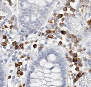 CALD1 Rabbit Polyclonal Antibody