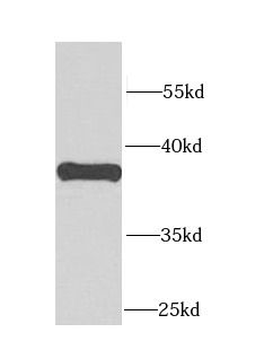 CALHM1 Antibody