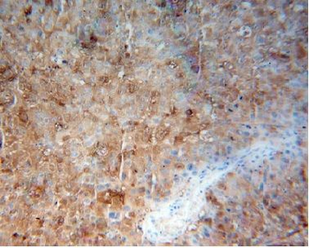 CALML5 Rabbit Polyclonal Antibody