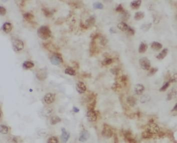 CALML6 Rabbit Polyclonal Antibody
