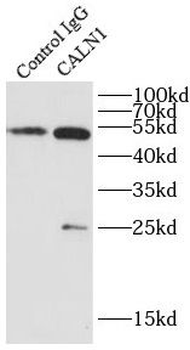 CALN1 Rabbit Polyclonal Antibody