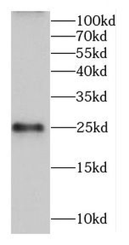 CALN1 Rabbit Polyclonal Antibody