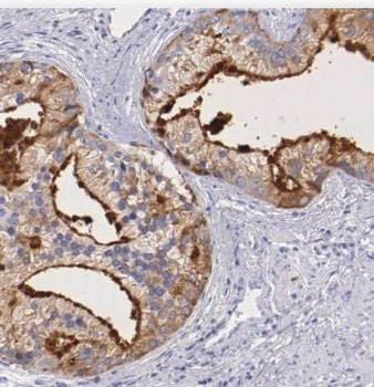 CALN1 Rabbit Polyclonal Antibody