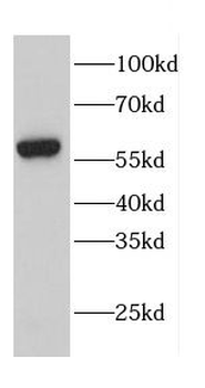 CALR Rabbit Polyclonal Antibody