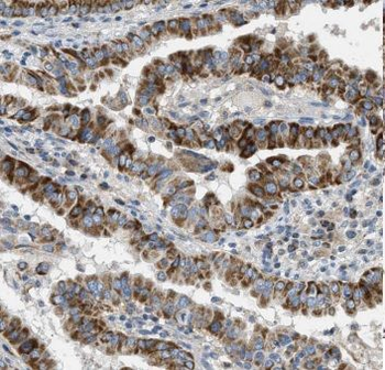 CALR Rabbit Polyclonal Antibody