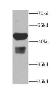 CAMK1D Antibody