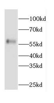CAMKK2 Antibody