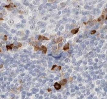 CAMP Rabbit Polyclonal Antibody