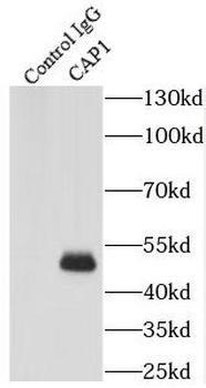 CAP1 Rabbit Polyclonal Antibody