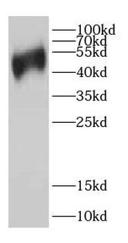 CAP1 Rabbit Polyclonal Antibody