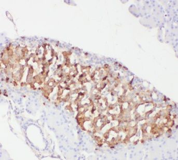 CAP1 Rabbit Polyclonal Antibody