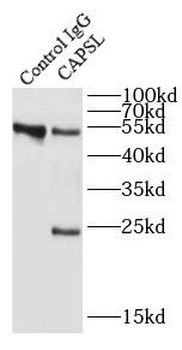 CAPSL Rabbit Polyclonal Antibody