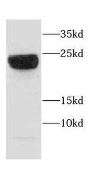 CAPSL Rabbit Polyclonal Antibody
