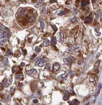 CARD8 Antibody