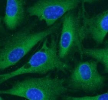 CARM1 Antibody