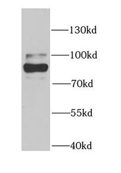 CARS1 Antibody