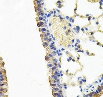 CARS1 Rabbit Polyclonal Antibody