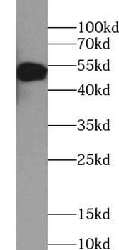 CASP2 Rabbit Polyclonal Antibody