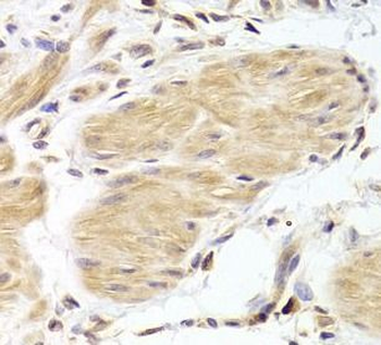CASP2 Rabbit Polyclonal Antibody
