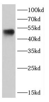 CASP2 Rabbit Polyclonal Antibody