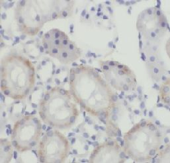CASP2 Rabbit Polyclonal Antibody