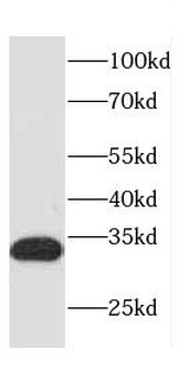 CASP6 Rabbit Polyclonal Antibody