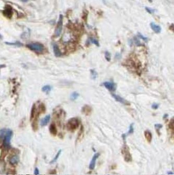 CASP6 Rabbit Polyclonal Antibody