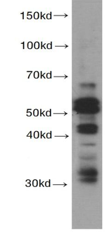 CASP8 Mouse Monoclonal Antibody