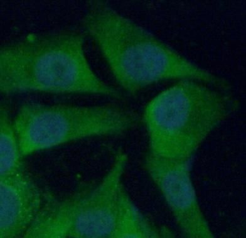CTSB Antibody