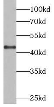 CTSB Rabbit Polyclonal Antibody