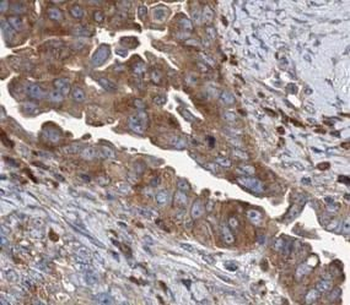 CTSB Rabbit Polyclonal Antibody