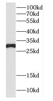 CTSG Rabbit Polyclonal Antibody