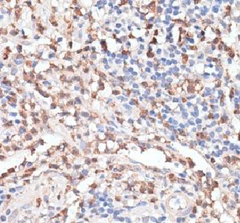 CTSG Rabbit Polyclonal Antibody