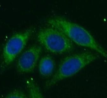 CTSK Antibody