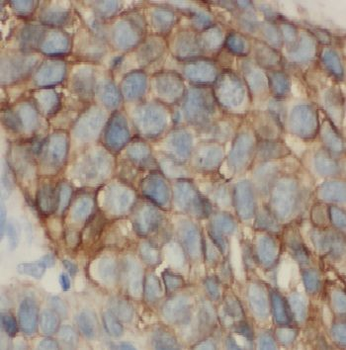 CAV1 Rabbit Polyclonal Antibody