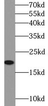 CAV1 Mouse Monoclonal Antibody