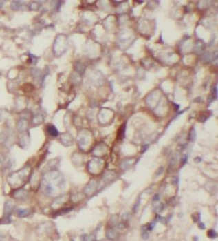 CAV1 Mouse Monoclonal Antibody