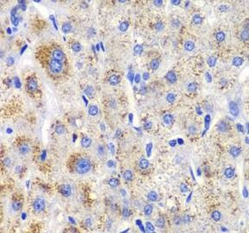 CBLB Rabbit Polyclonal Antibody