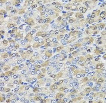 CBR3 Rabbit Polyclonal Antibody