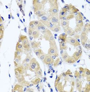 CBR4 Rabbit Polyclonal Antibody