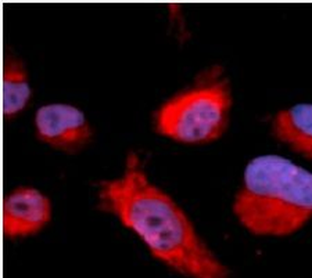 CBS Antibody