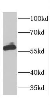 CBX2 Antibody