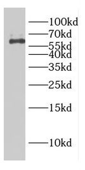 CBX6 Rabbit Polyclonal Antibody