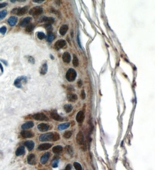 CBX6 Rabbit Polyclonal Antibody