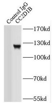 CC2D1B Rabbit Polyclonal Antibody